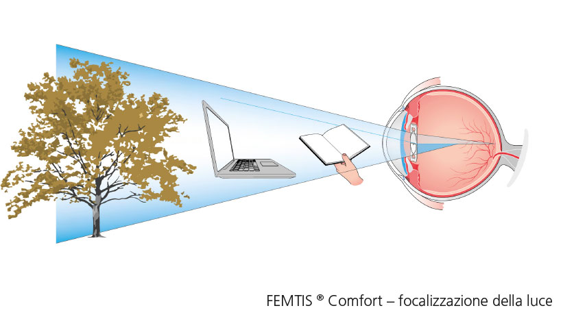 FEMTIS Comfort Lichtfokussierung IT neu