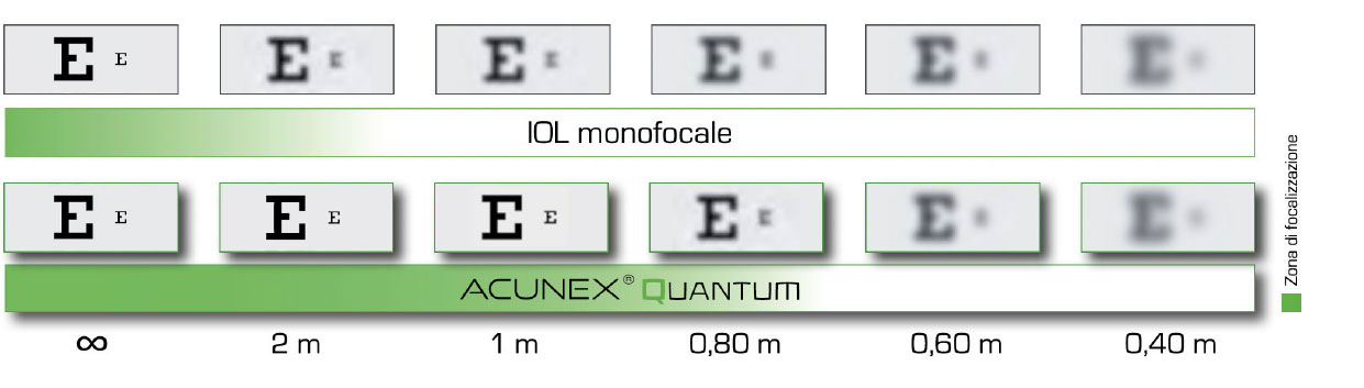 Abb. ACUNEX Quantum Enhanced Monofocal IT