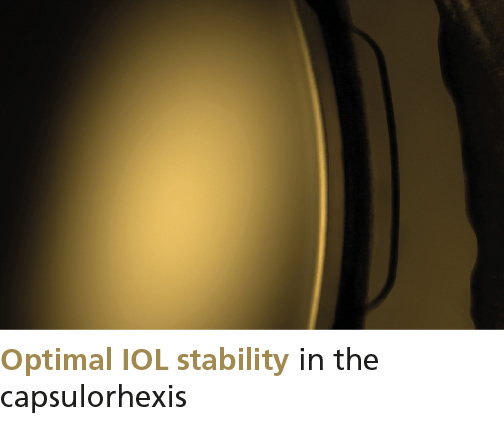 Optimal IOL stability