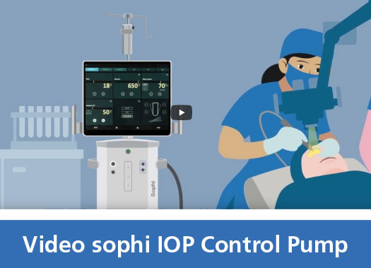 Teaser sophi Video IOP Control Pump
